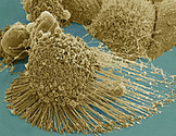 HeLa cell line HeLa cell line