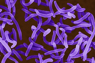 Vibrio Vibrio